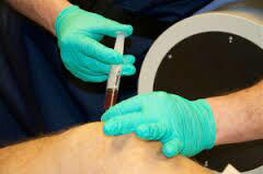 تزریق پلاسما در آرتروز زانو